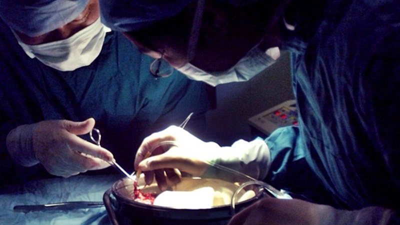 отнемане органи трансплантации